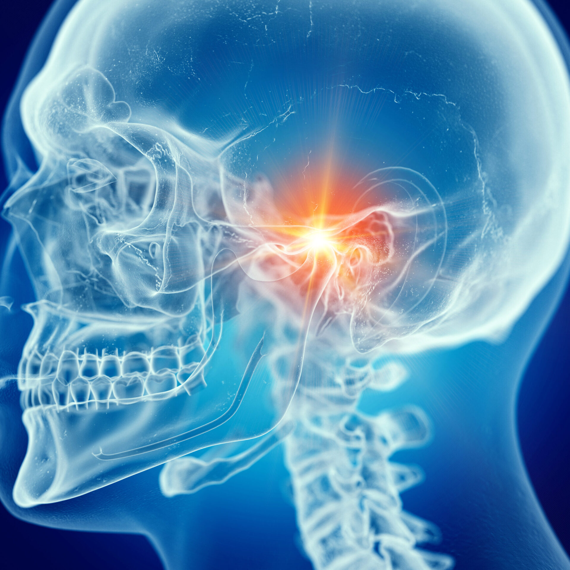 3d rendered medically accurate illustration of a painful temporo