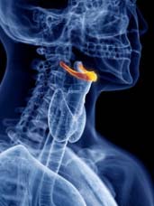 TN Hyoid01